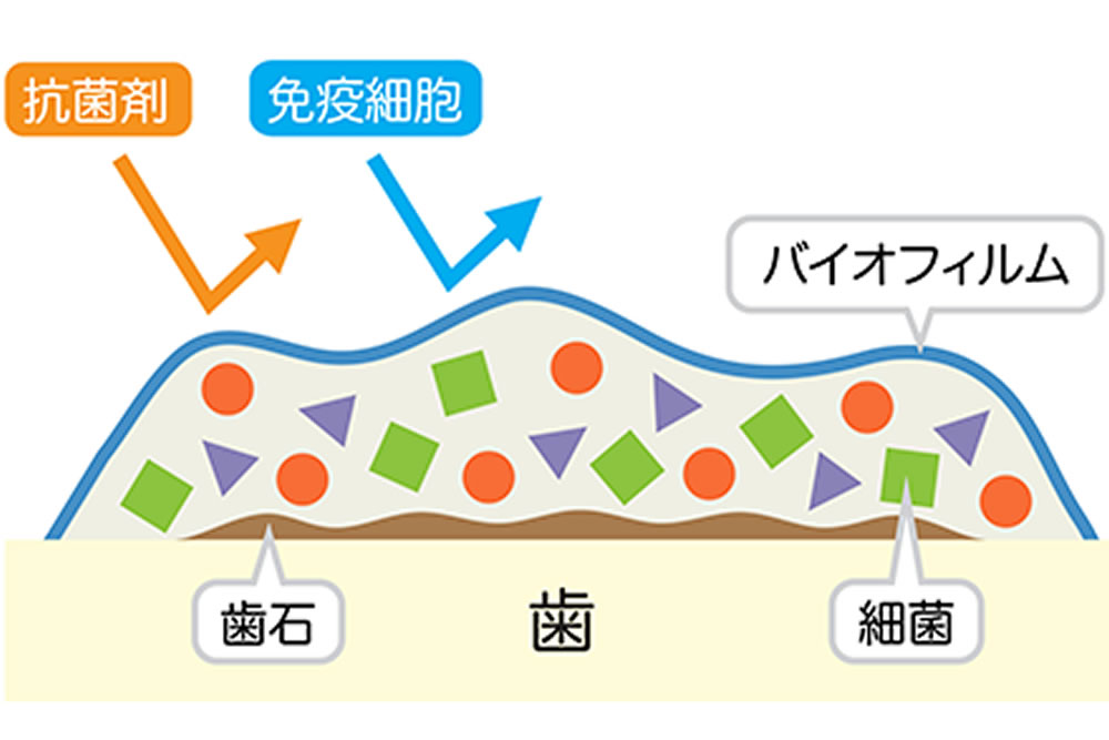 大田区中央（池上・大森）の歯医者、谷歯科クリニックの予防歯科