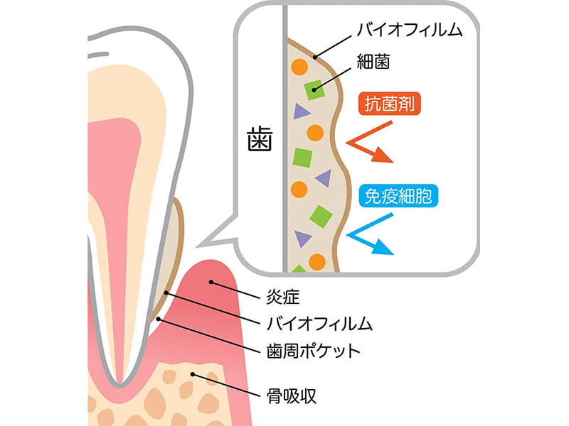 大田区中央（池上・大森）の歯医者、谷歯科クリニックの予防歯科