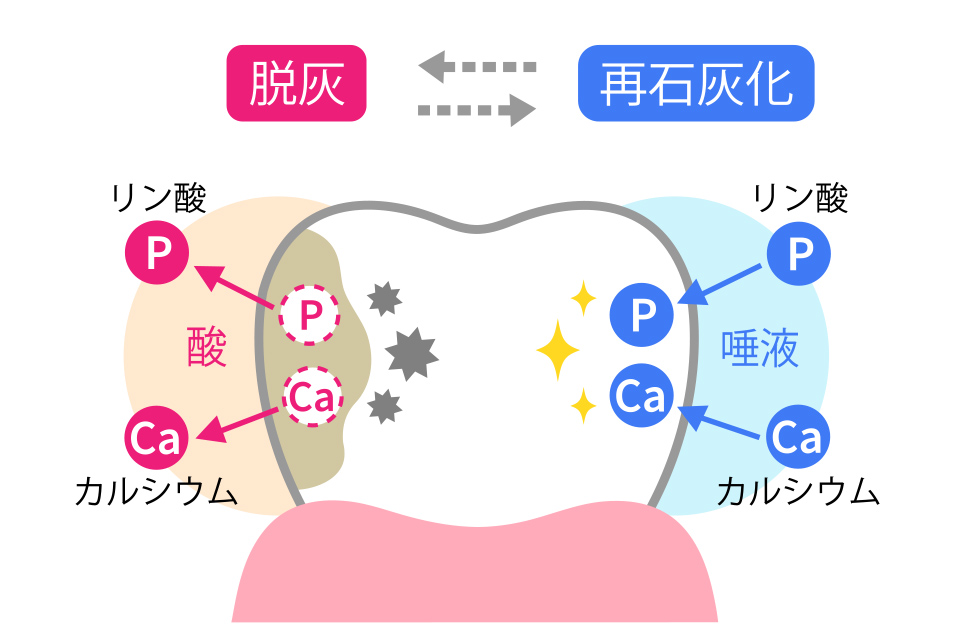 大田区中央（池上・大森）の歯医者、谷歯科クリニック、むし歯治療