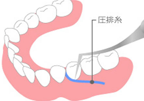 大田区中央（池上・大森）の歯医者、谷歯科クリニックの審美歯科