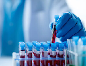 大田区中央（池上・大森）の歯医者: 谷歯科クリニックで歯科治療による金属アレルギーについての解説