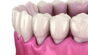 大田区中央（池上・大森）の歯医者: 谷歯科クリニックで高齢者の口腔トラブルについての解説